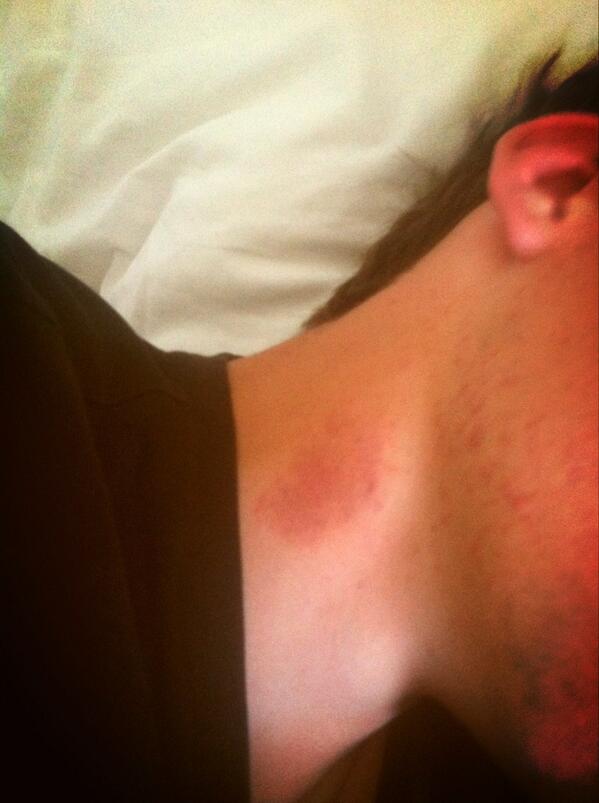 mich_griggs_16's tweet photo. @aupassout he had a good night #vampire http://t.co/fKXFM9NAj0