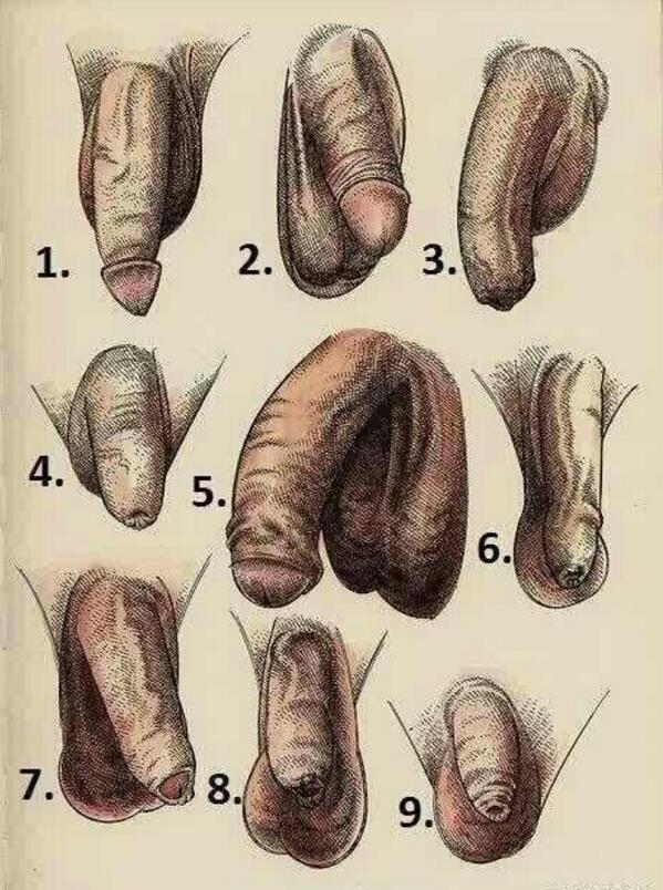 пенис Фото пениса виды