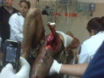 Trujilloooo24's tweet image. Oh my god 😷😷😷😷😷😷😷😷 #PrayersForKevinWare