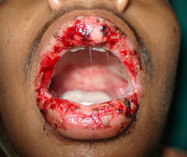 aophc's tweet photo. #AOPHC want to learn more abt how side n adverse effects of sme impt medicines may harm u? visit aophc group on FB http://t.co/3OzPlKGCB9