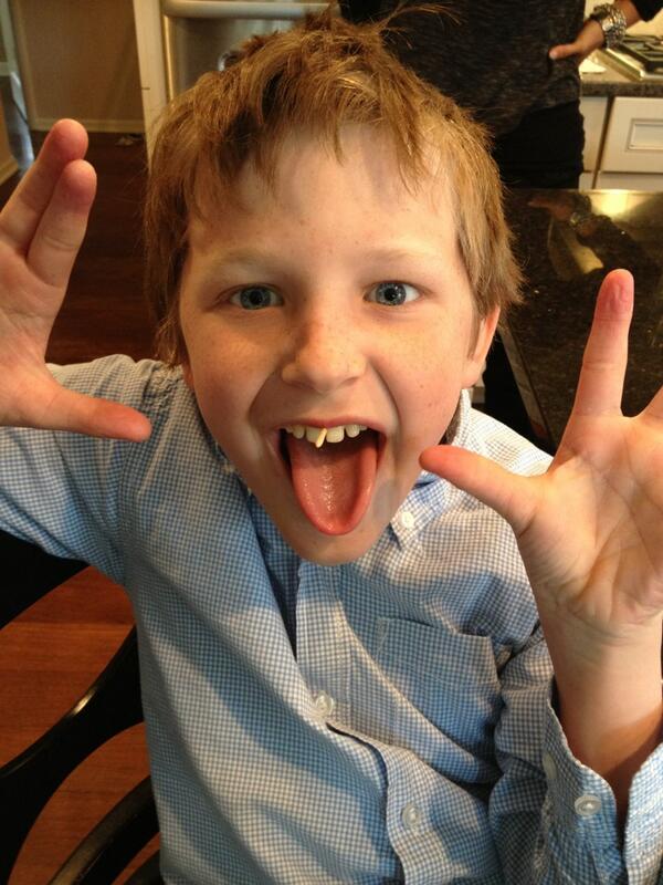 kennedygenzink's tweet image. gap teeth probs #toothpic