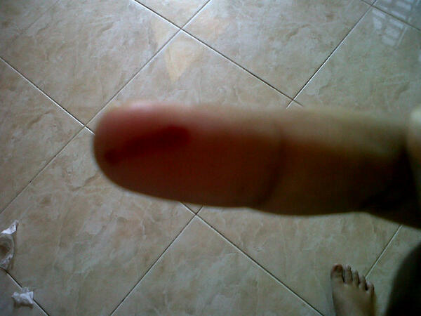 butterhersh's tweet image. Ouch my middle finger was bleeding #catproblem