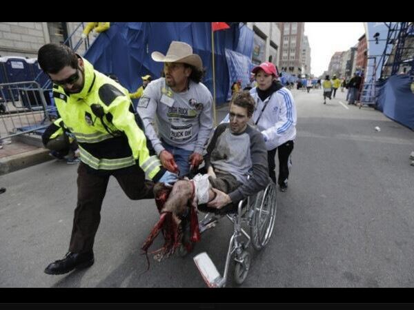 anthcraw's tweet photo. Very graphic picture from Boston marathon http://t.co/pH0bMSPVFH
