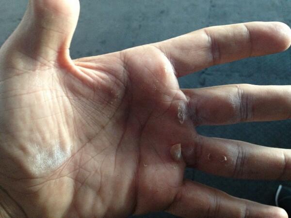 jlaratomas's tweet image. Las heridas son la muestra que no muero en la batalla #viveRX @RXMagazine