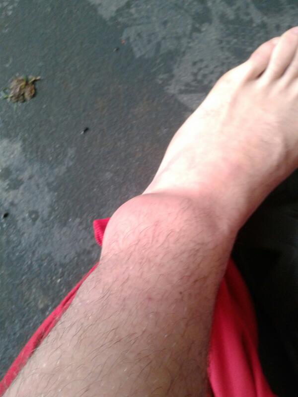 gorkasanta's tweet image. Como me duele el tobilloo joderr!! Tengo una pelota de teniss