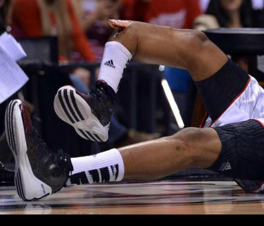 EliottCotton1's tweet image. if you have a weak stomach do not open this picture!! #pray4ware #basketball #sick