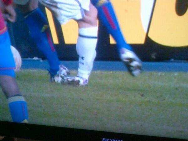 Jamie_Davis041's tweet image. That's bale's season over. Spurs-no CL football for you then #megapeak