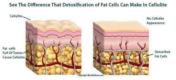 ChantzHough's tweet photo. The science behind this crazy wrap thing. 
Get your full treatment for just $59!
Click
https://t.co/yC405hqvZ4 http://t.co/1GbOF7CEAz