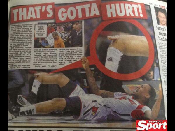 GESmiff's tweet image. And you think you've got it bad @TodayByJay @RossAds84 #vomitface 😱😣🚒