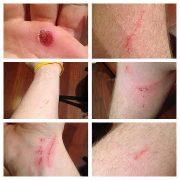 get_at_wes's tweet image. The higher the temperature, the more cuts and scrapes I get #warmweather #sonice #activeagain #goodpain #freshair