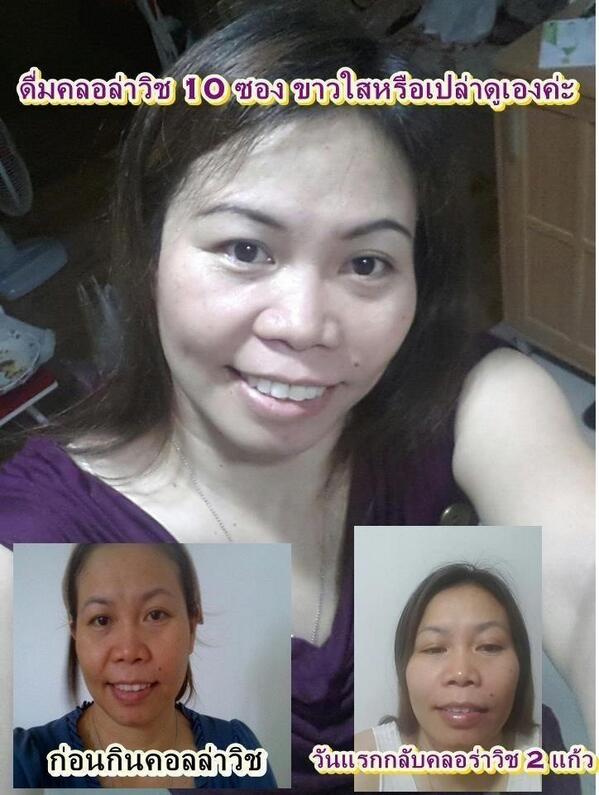 พรุ่งนี้คอลลาวิชของเราเปิดตัวแล้วนะคะ ใครสนใจจับจองกันได้เลย ผลจากการแทนเห็นความเปลี่บนแปลงเร็วมา สนใจติดต่อเลยนะคะ