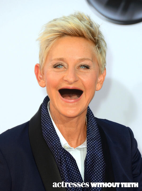 This should be a commercial for a gum disease ad! <a href="/TheEllenShow/">The Ellen Show</a>