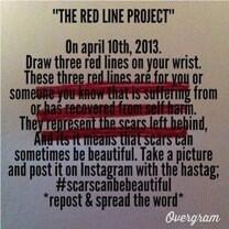 battle_wounds's tweet image. C&apos;MON GUYS RT THIS OR REPOST IDC BUT SPREAD THE WORD #redlineproject