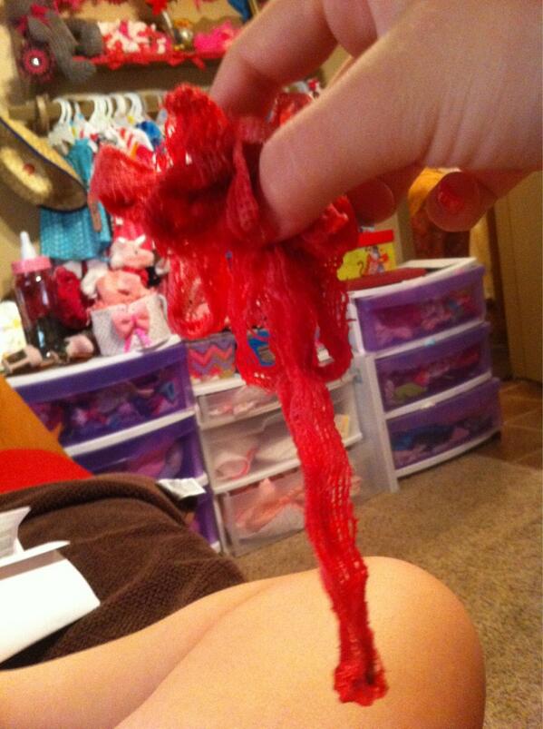 shiane_rena's tweet image. I just pulled 2 feet of gaw bandage out of my surgery spot.... #OWCHIE