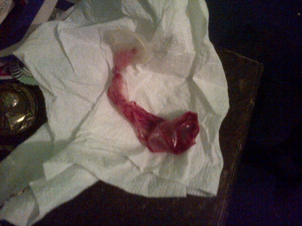 Randdyflangee's tweet photo. That's what happends when you fuck to hard http://t.co/0ICJ0PIBJG