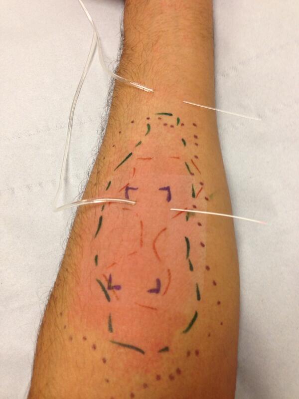 New craze in body art