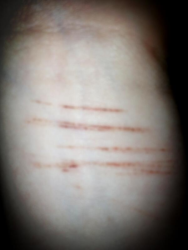 Selfharm16 tweet picture