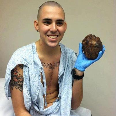 "Man after successful heart transplant holding his own heart! :) "