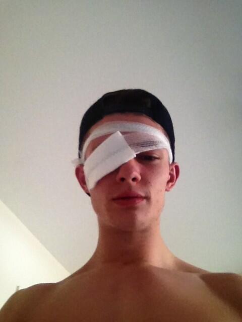 DarrenCooke53's tweet image. Who am a @LewisHeath hahahahahaha #eyepad