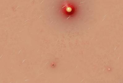 Acne_No_More2's tweet image. Regular Mistakes Acne Sufferers Makehttp://www.howcanigetridofpimples.com/
#Acne #Pimples #FaceProblems #SkinCare