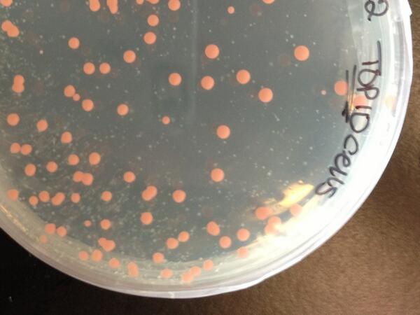 Frightened of what's growing in the lab. (Colonies are usually white...)