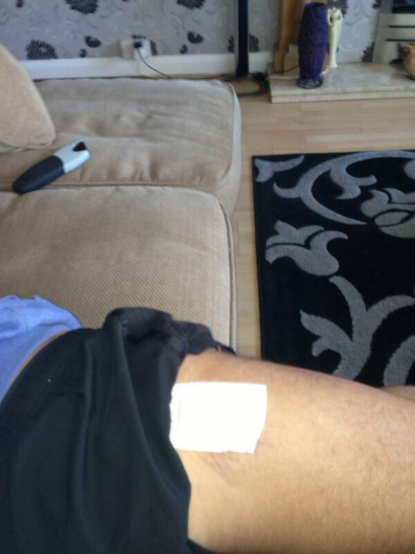 DomRichardson's tweet image. This is what summer means for footballers. #hardground #grassburns #bigweep #toomuchsliding #stayonyourfeet