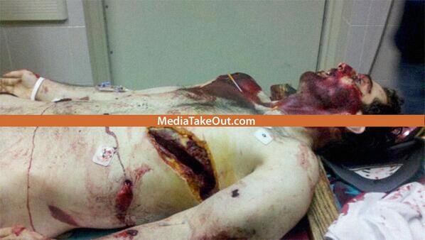 El_FEO32's tweet photo. "@chatomane8: Death pic of one of da Boston bombers GRAPHIC! http://t.co/Bk9P18hYgW" tight.....!