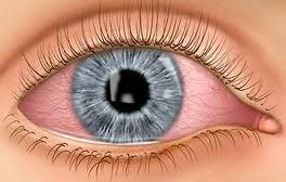 TianaBrooke96's tweet image. Putting in new fresh contacts #contactproblems