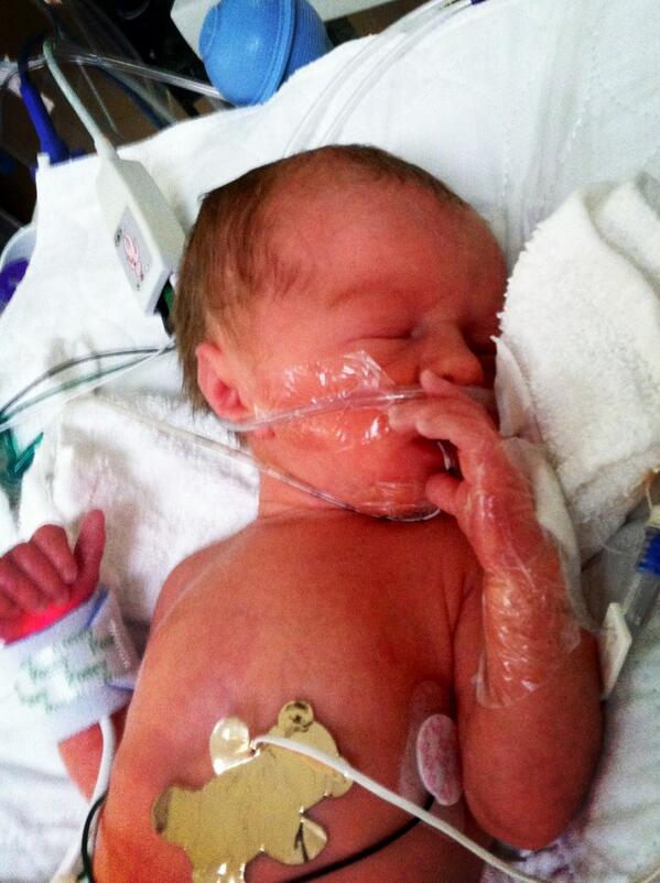 SHS_CoachFeigh's tweet photo. Jace Easton Feigh. 3lbs. 12oz. 17.5in He decided to come a little early at 32 weeks, but he is doing well. #happy http://t.co/IJB9kN0twO