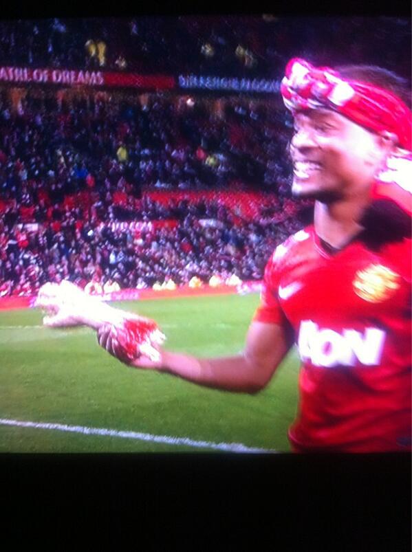 Marsh1484's tweet image. #severedhand quality!!