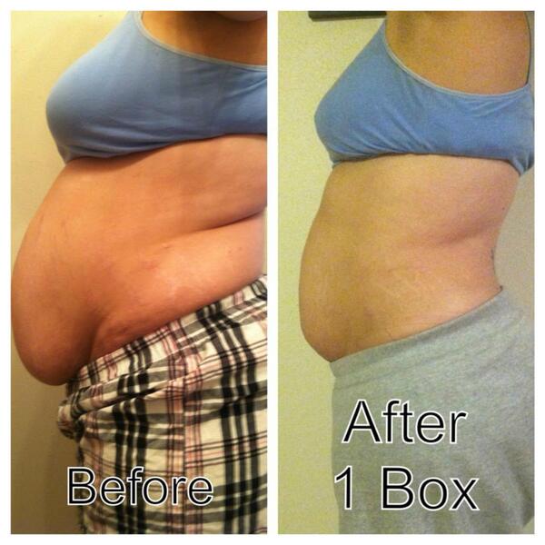 EffortlessTone's tweet photo. Take the #easywaytolooseweight and #trimdown #allnatural #toning and #lookgoodforthesummer #nomorebabyfat #moms http://t.co/43wU4yVmh6