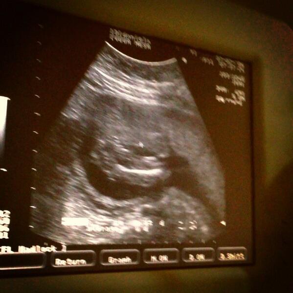 bebegrrrr's tweet photo. Oye @viajaVolaris #MamáNoViajaSin llevarme en su pancita!! RT mil!! http://t.co/Q9lCKSEd7v