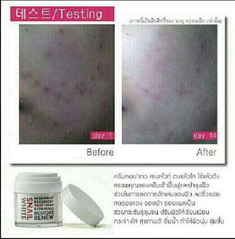 SnailwhiteThailand tweet media