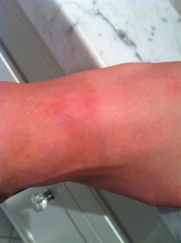 rachelparker_'s tweet image. I was outside for 30 min and managed to get a tanline. #rachelproblems