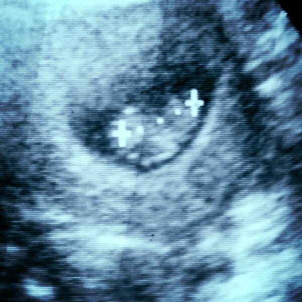 Yuhuu.. Yg di dlm sanaaa... #MayDay