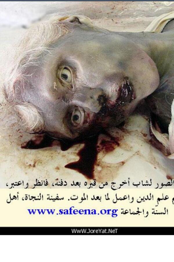 HaddadSaa122's tweet photo. لا أله إلا الله 
صورة لشاب اخرج من قبرة بعد ثلاث ساعات 
من دفنة 
سألو عنة ؟
فقالو لم يكن يصلي وكان يستمع الي الأغاني http://t.co/LpVN26pqqH
