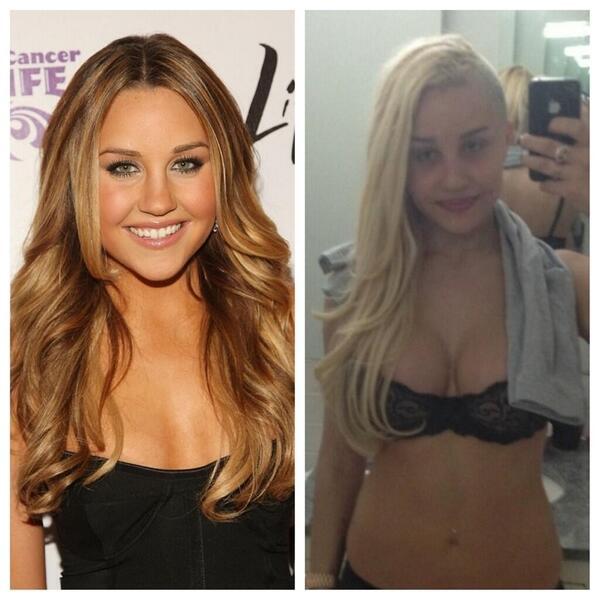RE: Amanda Bynes looks like a 2 cent crack whore as of late. 