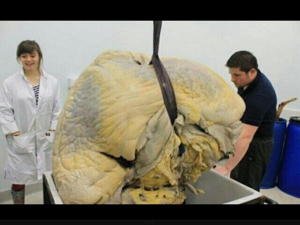 strangest_pics's tweet photo. هذا قلب الحوت سمعت به ولاكن هل رأيته http://t.co/2lSWOzmclu