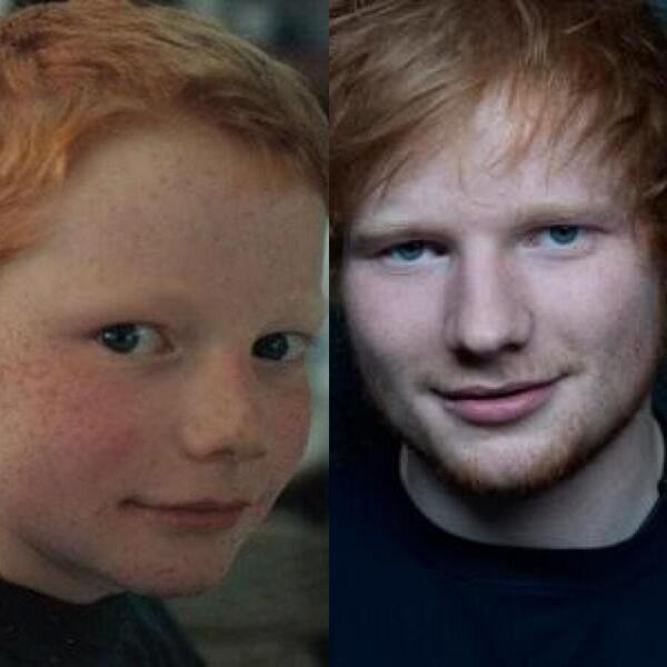 CelebsAfter's tweet photo. Ed Sheeran http://t.co/3KkBUg0RRZ