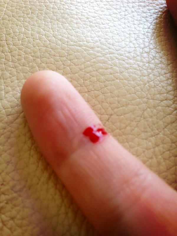 Cut myself on a dairylea dunker. Thug life chose me. #nofear #noregrets