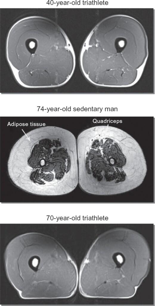 mhnoland's tweet photo. The power of staying active through life http://t.co/CJARhWh2vT