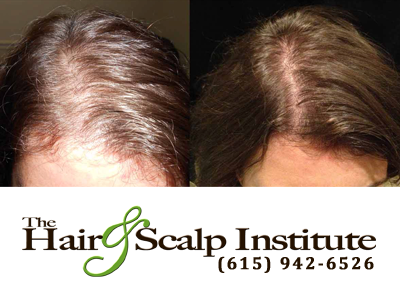 HSINashville's tweet photo. Results you can SEE! Call us today to set up a free consultation!

http://t.co/7shCvOMo3a http://t.co/2bqTZ6vU1M
