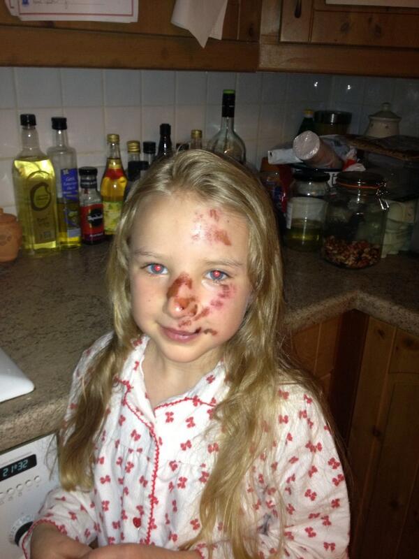 Clivejenkins's tweet photo. @TeamSky step daughter's first major crash - classic over the bars. Any chance of a reply to cheer her up? http://t.co/myenplqY1g