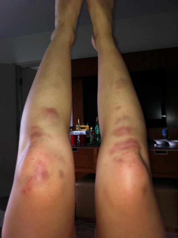 hanangl's tweet image. reflecting on the #spartanrace a year ago &amp;amp; how horrific &amp;amp; unpleasant it was until i got to the finish line #whyagain