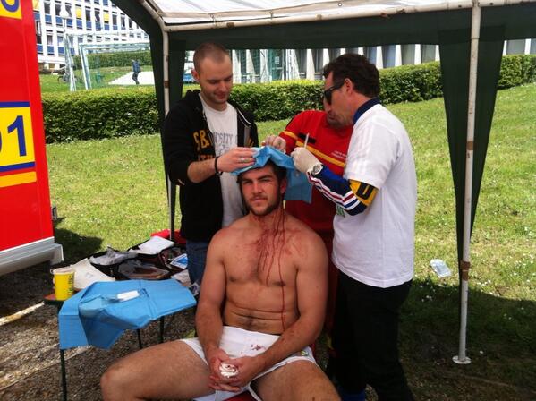 “<a href="/CentraleSeven/">Centrale 7</a>: SudAf are tough guy! The first stitches ” @deej909 Nic de Jager bleeding Maroon!