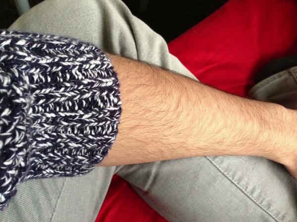 #TweetYourArmhair <a href="/arm_hair/">Arm Hair Technology</a>