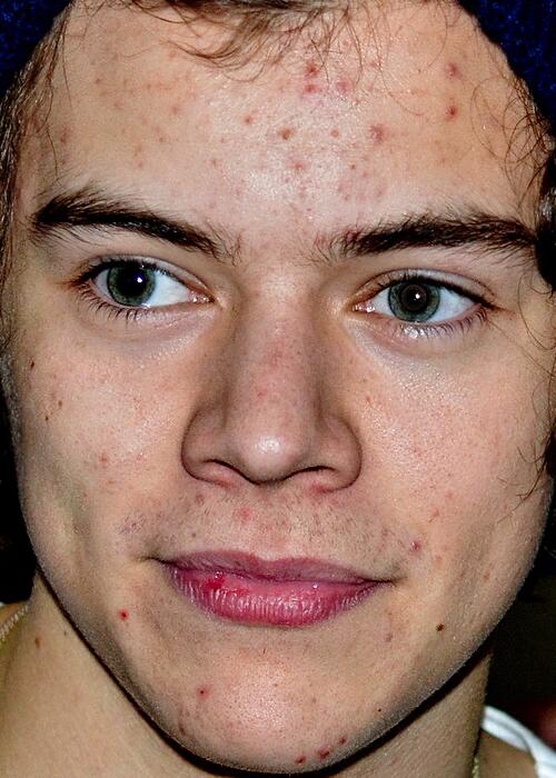 harry styles without makeup harry styles without makeup