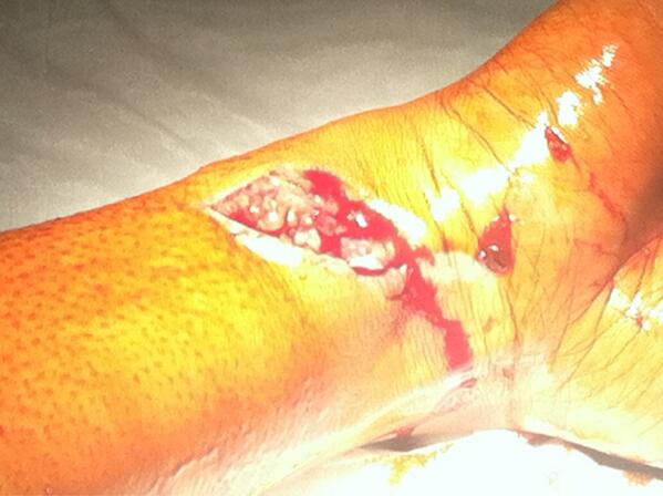 ChillKitchen's tweet photo. On today's episode we're down a man after he flayed his wrist on the DUMPSTER! Ew fuckin gross! http://t.co/liSWMBf3v6