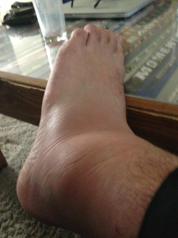 ellio_6's tweet photo. @tj_lawr @cpencakes @jlmacey moving a little slow. No wheelchair required. http://t.co/ab7sM49IYe