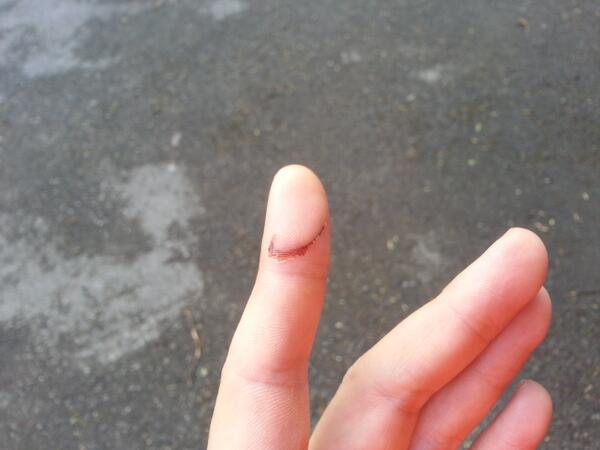 s86white's tweet photo. @NikeUK stupid knife accident looks like the nike swoosh http://t.co/tXB9HILPwH